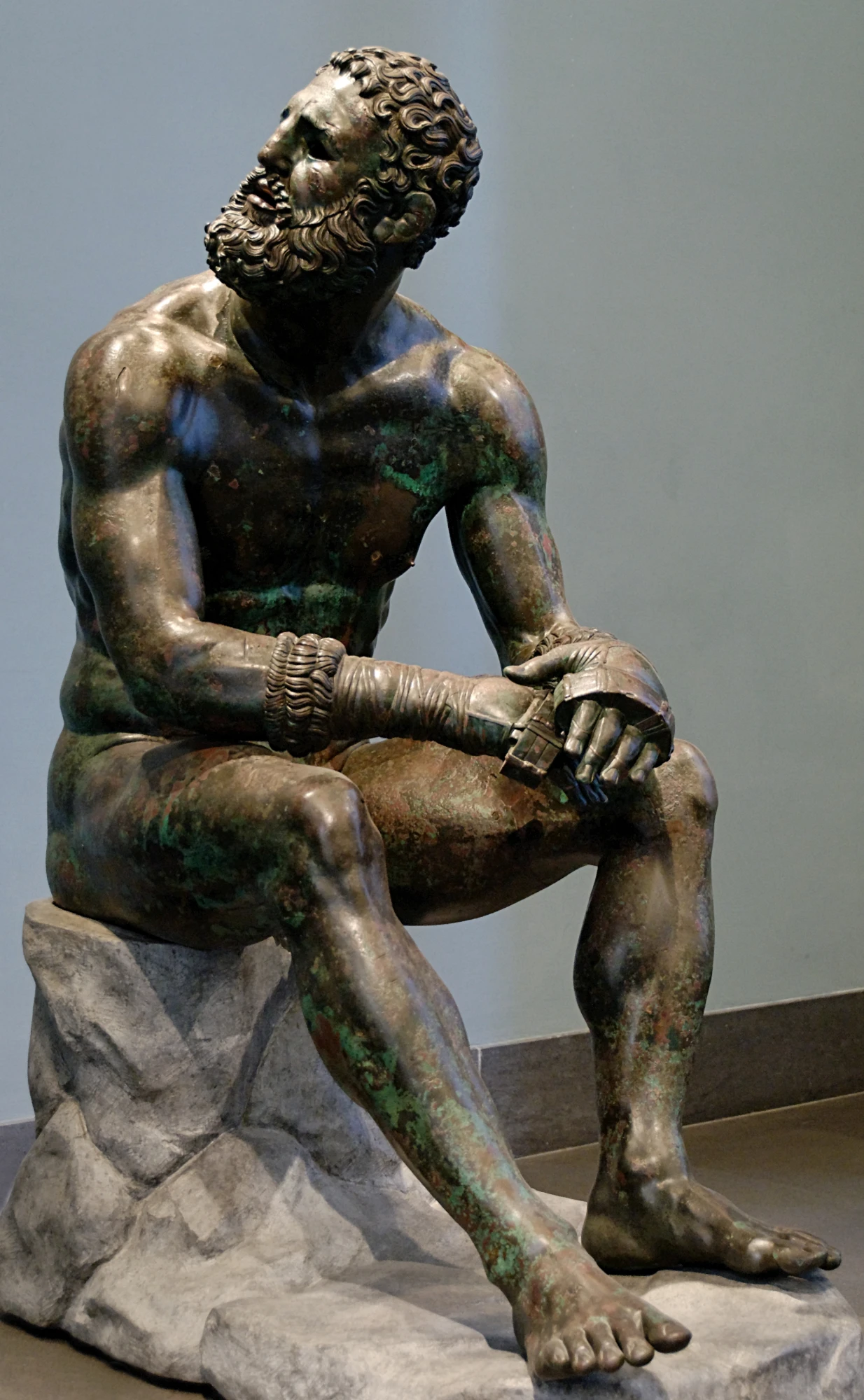 Pugilista em repouso: estátua grega de bronze de um homem de barba, sentado, com as mãos enfaixadas